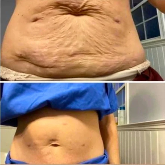 NuSkin Renu Spa in box - Picture 6 of 9